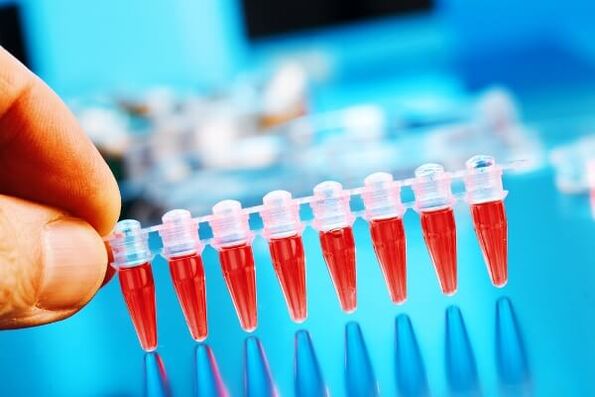 Blood test for cervical osteochondrosis to exclude oncology