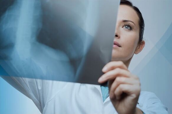 Radiography is a popular method of diagnosing cervical osteochondrosis.